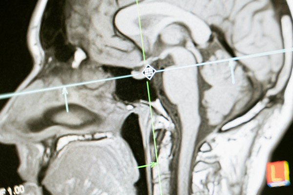 Sanderstead Osteopaths Emerges as a Trusted Clinic for Back Pain, Sciatica and Cranial Treatment in Croydon